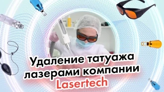 Удаление татуажа лазерами компании Lasertech